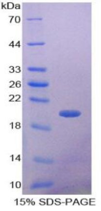SDS-PAGE (Gdf9-643M).jpg